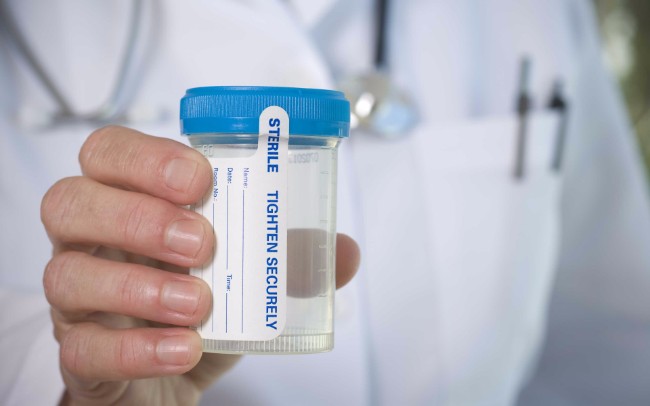 What Employees Need To Know About DOT Drug Testing
